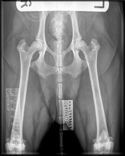 Rudolph Hip Score X-Ray